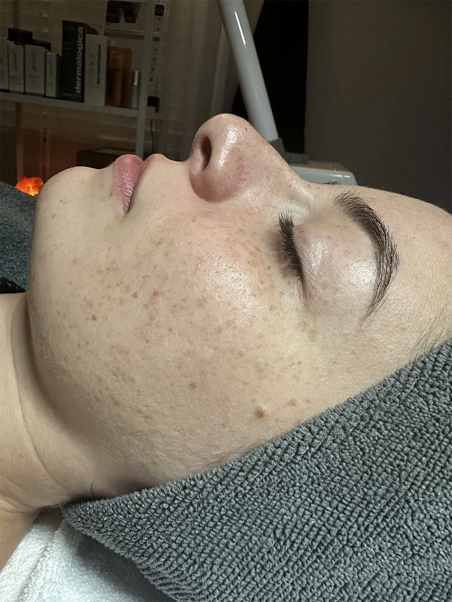 Essential Facial for Healthy Skin Maintenance