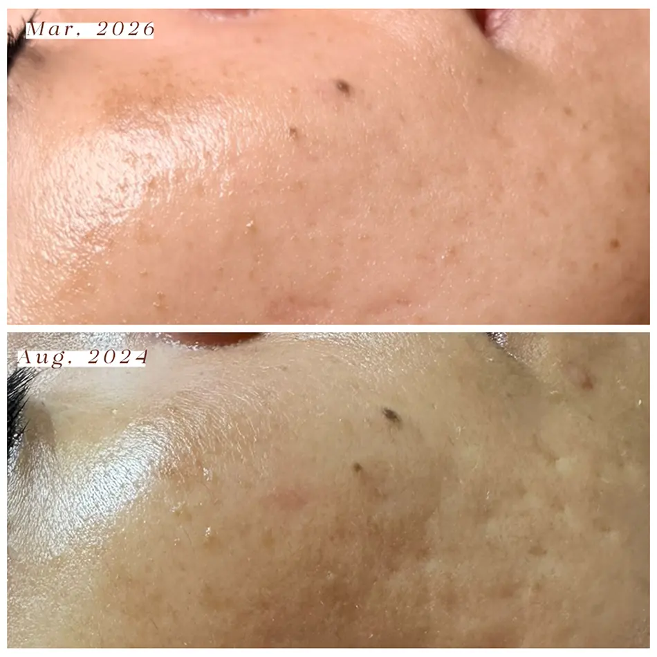 Signature Luxe Facial 